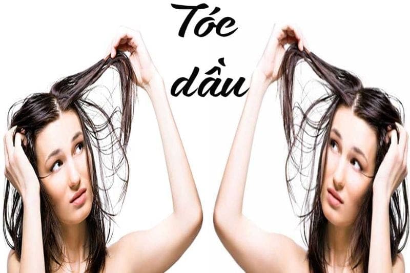 Top 10 loại dầu gội cho tóc dầu được lựa chọn nhiều nhất