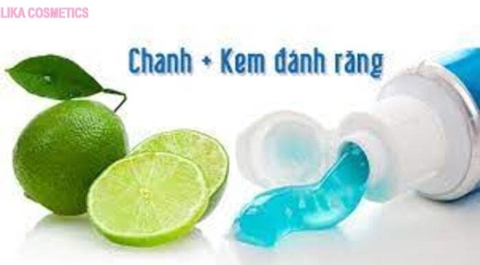Những điều cần biết về trị mụn bằng kem đánh răng