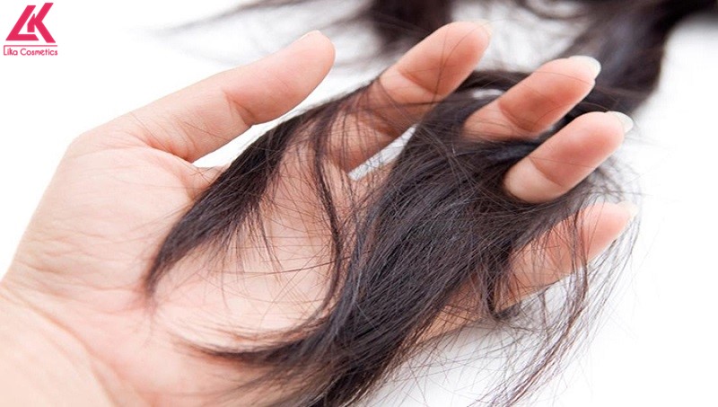 Bổ sung dinh dưỡng rất quan trọng tránh bị rụng tóc